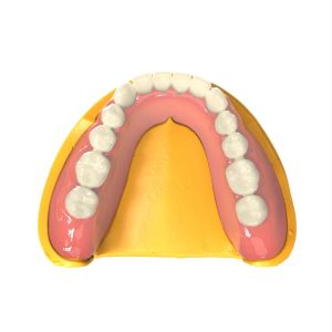 Foundation 3d Printer Dental Resin Customized Biocompatible Resin 3d Printing