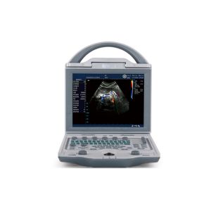 10.4 Inch Screen Portable Ultrasound Scanner Color Doppler Machine With Trolley