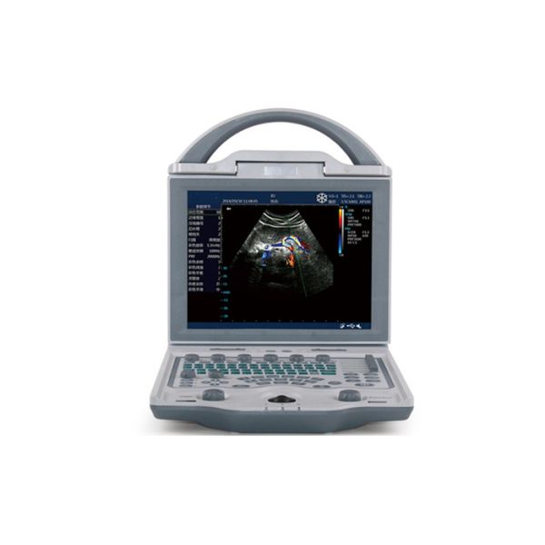 Portable Echocardiography Machine Portable Ultrasound Scanner With 10.4 Inch