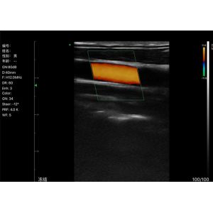 Color Ultrasound Machine Home Ultrasound Scanner Portable Ultrasound For