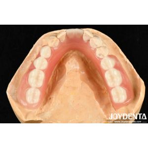 Diverse And Lightweight Resin Material Acrylic Denture Finish