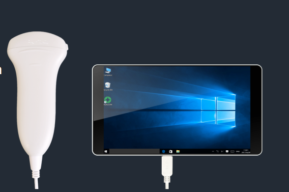 Vet Use 3.5 MHZ Mini Portable Ultrasound Scanner Android Or Windows Operating System