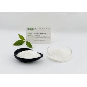 Active Undenatured Type II collagen Is The Key Ingredients Of Joint Health