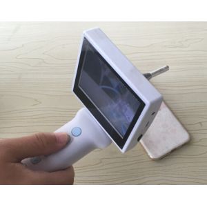 10X Magnification Ophthalmology Equipment