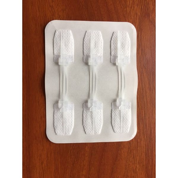 Plastic Material Consumable Medical Devices Zip Wound Closure System Easy To