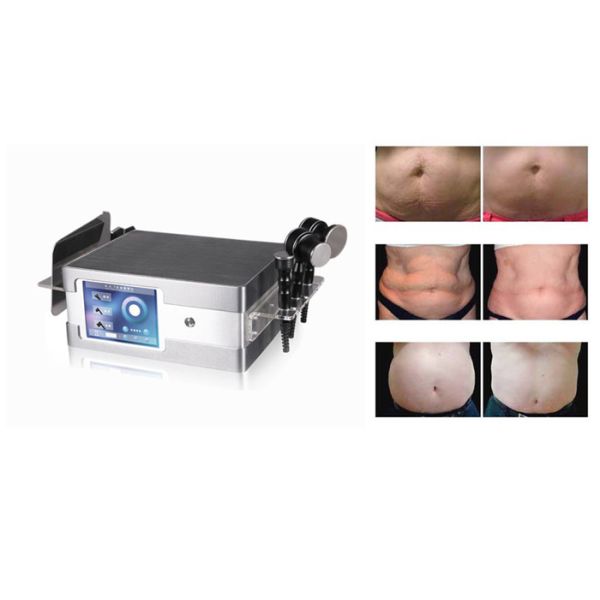 High Frequency Cavitation Rf Slimming Machine Fast Fat Burning With Direst