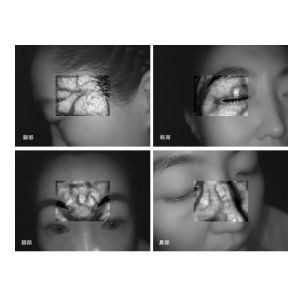 BS6000 Vein Viewing System Vein Locator Device With Led Light and 8 Inch Touch