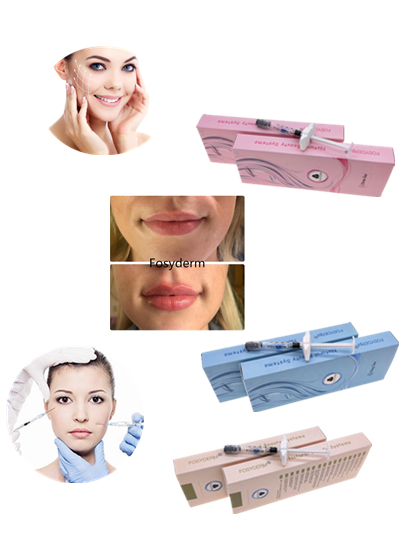 Lidocaine Hyaluronic Acid Injectable Dermal Filler For Face Lip