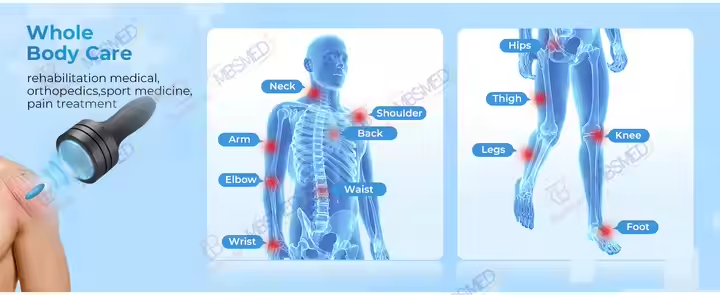 Focus Shock Wave Deep Tissue Regenerator 120mm Vet ESWT Focused Shockwave