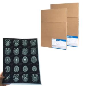 Dry Pix X Ray Film Fuji DIHL X Ray Medical Dry Laser Imaging X Ray Film