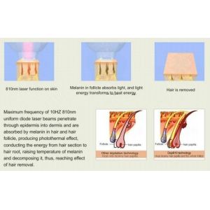 Laser Emitter Diode Laser Hair Removal Machine With 'In-Motion'