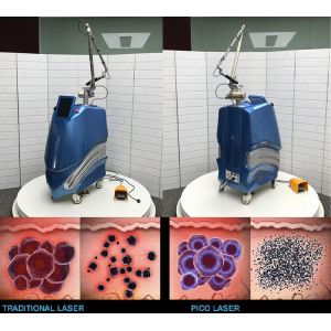 Optional 650 580 755 Picosecond Nd Yag Laser Enlighten Pico Laser For Tattoo