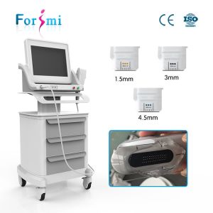 rf face non surgical lift face machine hifu frequency HIFU face firming ultrasound HIFU