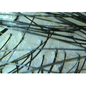 2 Million Pixels Wireless Portable Dermatoscope Digital Skin And Hair Analyzer