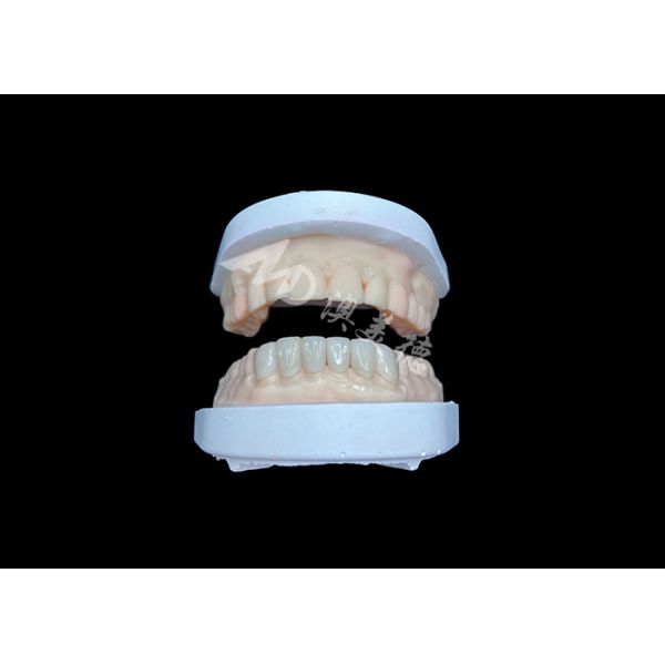 Quality IPS Emax Veneers Natural Looking Restorations For Esthetic Smiles wholesale