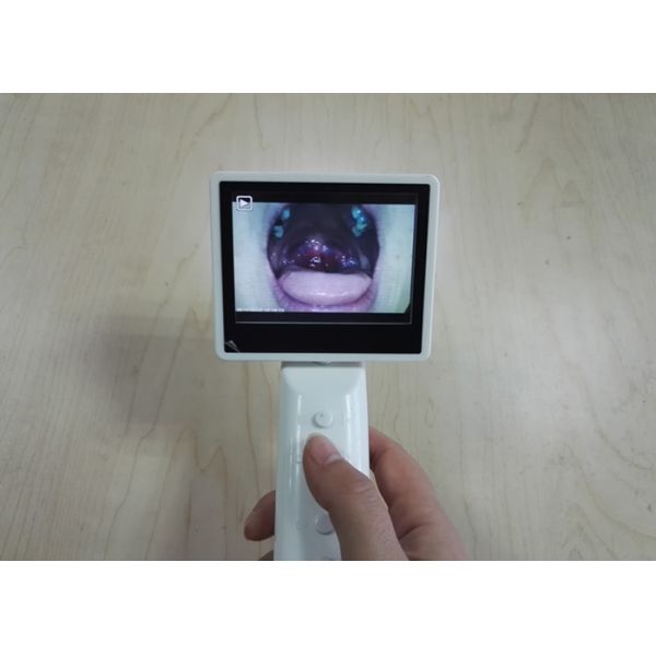 Quality SD Card Storage ENT Diagnostic Equipment Otoscope Ophthalmoscope Automatically With USB Cable wholesale