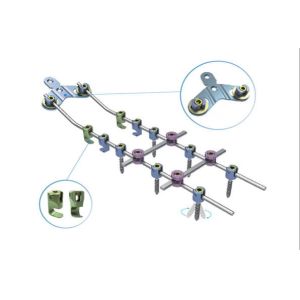 Posterior Cervical Internal Spine Fixation System , Pedicle Screw System