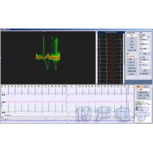 Cheap Holter ECG Software 3/12 Channels 24-Hours Ambulatory ECG Holter Monitor HRT, T-wave alterans &amp; HRV for sale