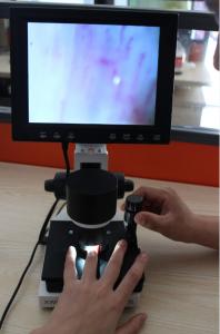 Cheap High Definition LCD Microcirculation Checking Microscope Nailfold Video Detection Instrument for sale