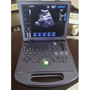 China 2D Portable Ultrasound Machine With PC Platform AV220V 60Hz on sale