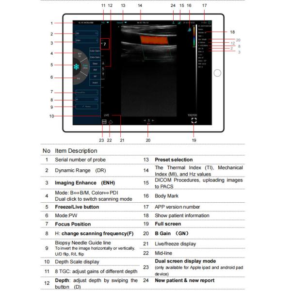 GH G10RL USB Portable Color Doppler Ultrasound Transducer Machine