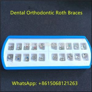 Comfortable Orthodontic Treatment with Low Torque Self Ligating Brackets and CE