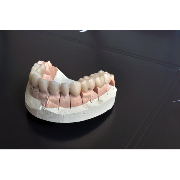 Anterior Posterior Multilayer Zirconia Blocks Dental 16 Shades 98*18mm