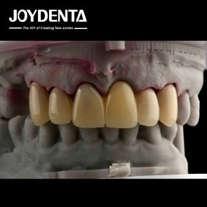 China CAD CAM Processing Dental PMMA Material Multilayer Design For Natural Shade Transitions on sale
