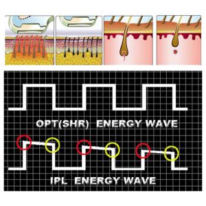 Vertical SHR hair removal machine with 2 handles