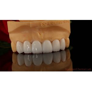China Full Contour Zirconia Crown Translucency 3D PRO No Porcelian Overlay Standard Dental Lab on sale