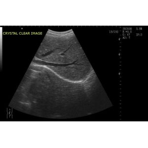 USB Ultrasonic Transducer Probe Handheld Ultrasound Scanner Wireless Only 150g