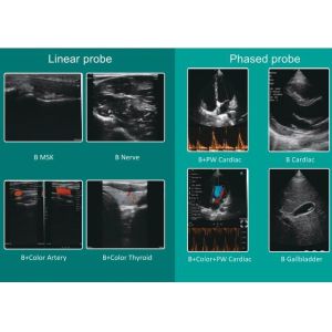2.2MHz Mobile Portable Ultrasound Scanner Linear+Cardiac Probe 7.5/10MHz