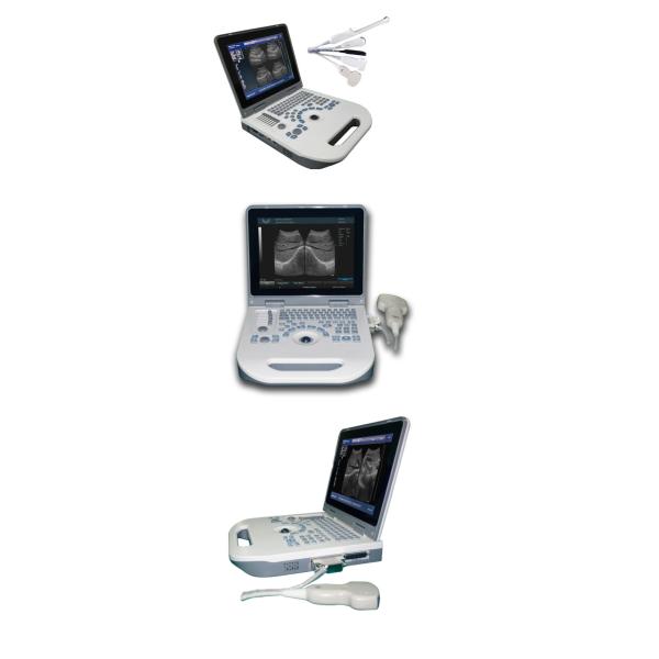 4D Color Ultrasound Portable Ultrasonography Machine Digital
