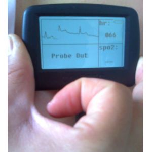 Multi-function digital visual electronic stethoscope + ECG + spo2 pulse oxygen