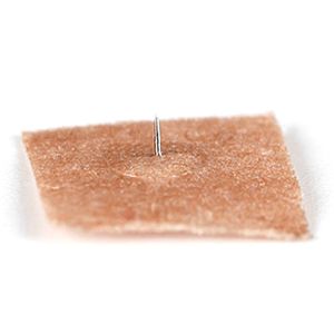 China Single Performance Acupuncture Therapeutic Needles With Plastic Handle And 5 Years Shelf Life on sale