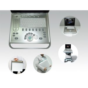 Portable Color Doppler Ultrasound Machine With Measurements And Calculations
