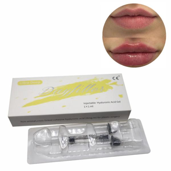Quality Deep Hyaluronic Acid Dermal Filler Cross Linked 2ml Ce wholesale