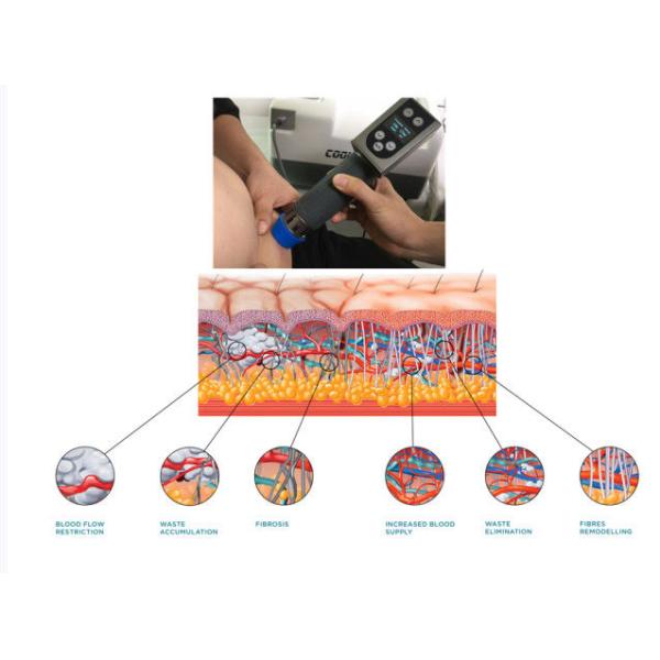 COOL WAVE Beauty Equipment Fat Removal Fat Freeze Cryolipolysis Shockwave Therapy Machine With CE