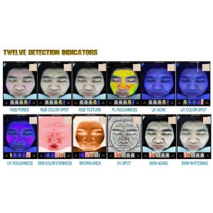 Cosmeti Facial Analyzers Machine Therapist Deep Detect 10 Years Warty