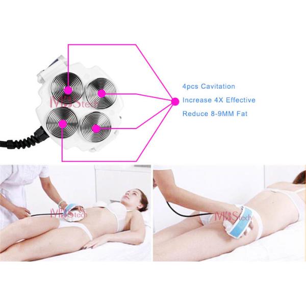 Ultrasonic Cavitation RF Machine