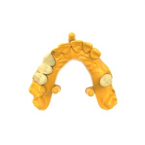 Low Temperature Expansion Coefficient Permanent Crown Resin Close to Natural