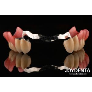 Framework Setup Teeth Finish Elaborate Technology Beautiful Harmonious