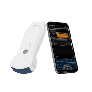 Handheld Portable Bladder Scanner Wireless Connection To Mobilephone Tablet