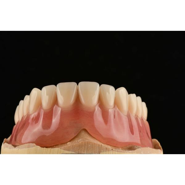 Comfortable Clear Adjustable Removable Partial Denture That Resemble Natural