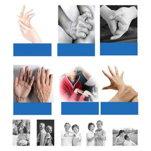 Medical Stroke Rehab Devices For Handicapped Hand Dysfunction Chopsticks