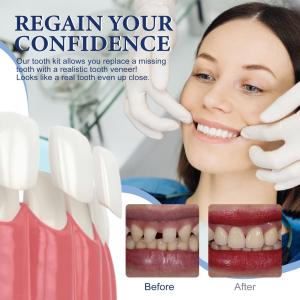 Temporary Tooth Repair Kit Moldable Natural Shade Filling For Missing Or Broken