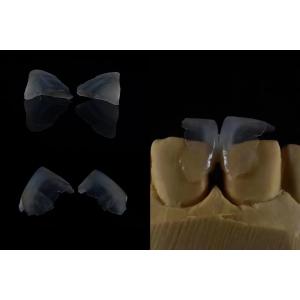 Cheap Comfortable Dental Veneers Strong Bond With Tooth Enamel For Secure Fit Lightweight And Smooth For Optimal Patient Comfort for sale