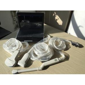 Transvaginal Handheld Ultrasound Scanner With 5 Kinds Of Probe Heads Exchangeabl