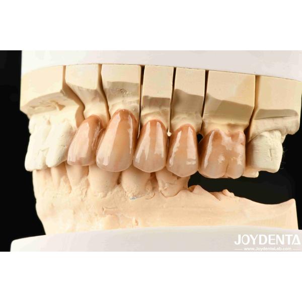 Quality Bionic Development Leaves And Distinct Layers Of Zirconia All-Ceramic wholesale