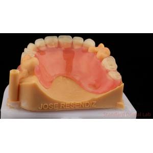 3D Print Model Dental TCS Valplast Flexible Partial Dentures Pink / Dark Color